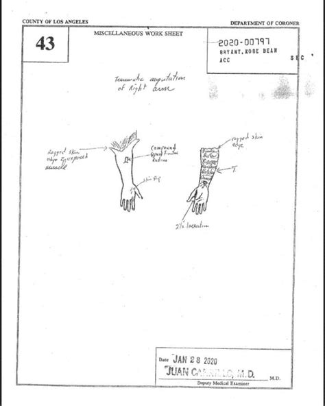 gigi autopsy sketch|Bryant Daughter Gigi Autopsy Sketch